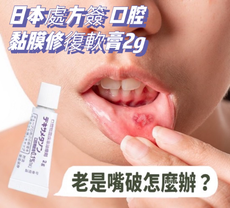 日本處方簽 口腔黏膜修復軟膏 5g:圖片 3